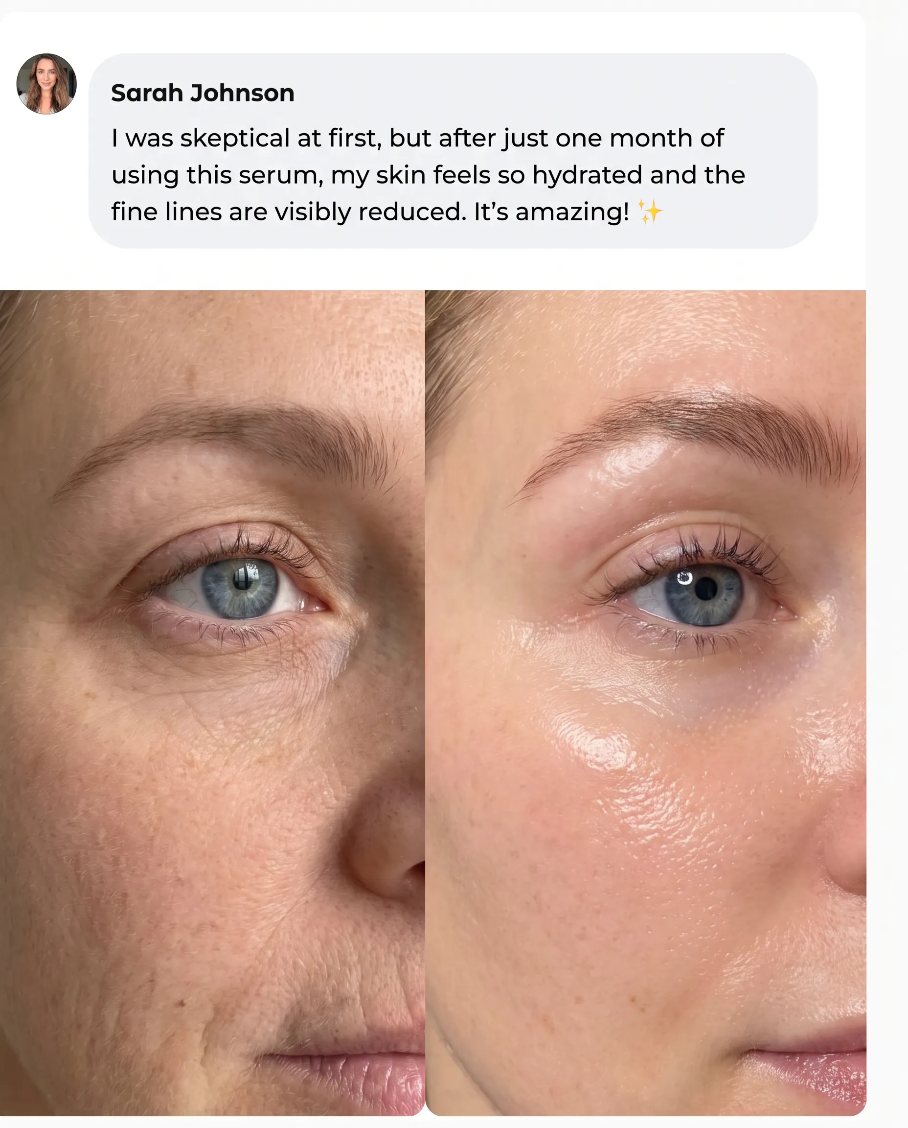 Transformation 4