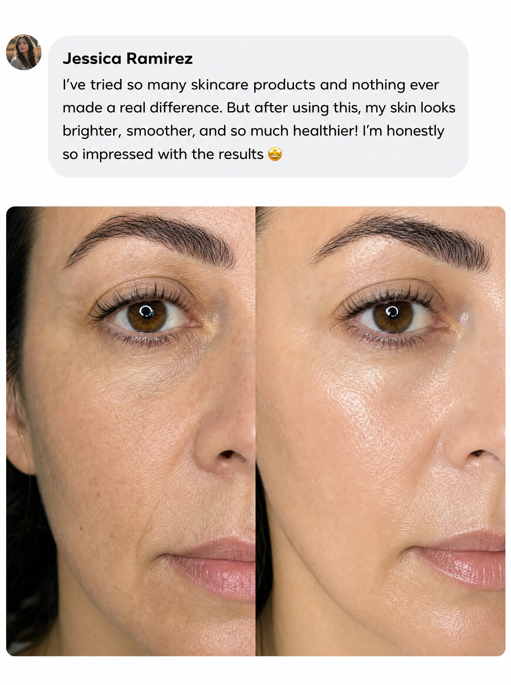 Transformation 5
